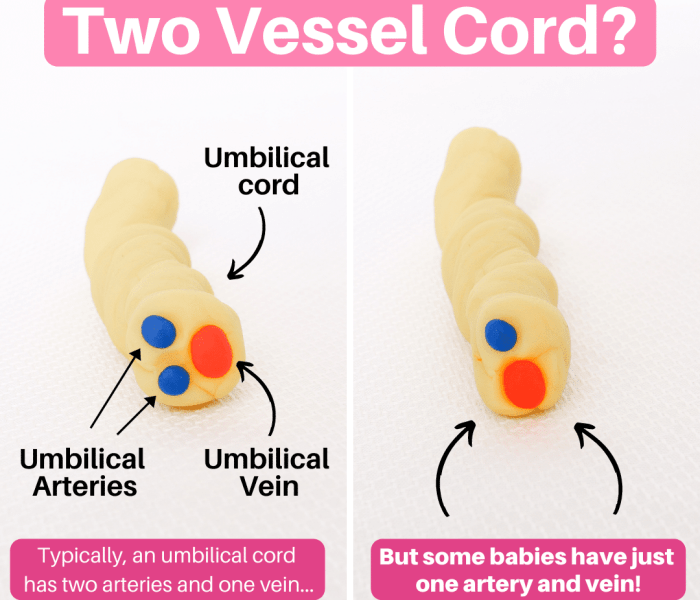 Umbilical cord drawing easy