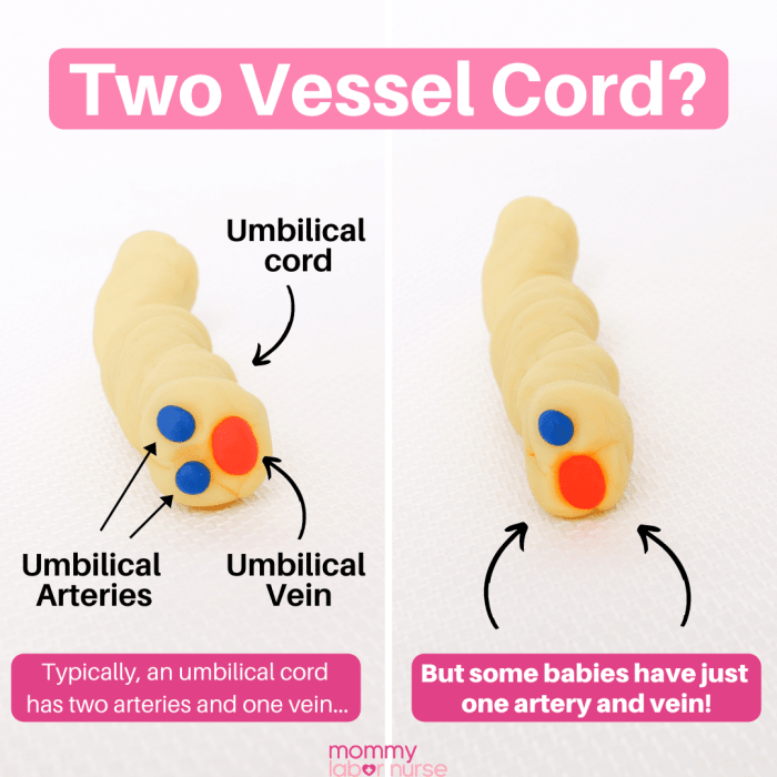 Umbilical cord drawing easy